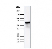 Western blot testing of human Hep2 cell lysate using HSP60/GROEL antibody (clone HSPD1/6498R). Predicted molecular weight: ~60 kDa.
