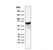 Western blot testing of human Hep2 cell lysate using HSP60/GROEL antibody (clone HSPD1/6498R). Predicted molecular weight: ~60 kDa.