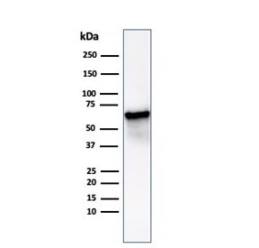 Western blot testing of human Hep2 cell lysate using HSP60/GROEL antibody (clone HSPD1/6498R). Predicted molecular weight: ~60 kDa.