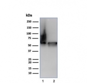 Western blot testing of human 1) Hep2 and 2) HeLa cell lysate using HSP60/GROEL antibody (clone HSPD1/6498R). Predicted molecular weight: ~60 kDa.