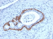 IHC staining of FFPE human prostate tissue with Cytokeratin 14 antibody (clone KRT14/4129). HIER: boil tissue sections in pH 9 10mM Tris with 1mM EDTA for 20 min and allow to cool before testing.