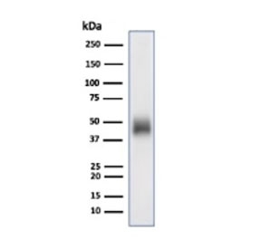 Western blot testing of human Raji cell lysate using CD48 antibody (clone CD48/4785). Expected molecular weight: 28-50 kDa depending on glycosylation level.