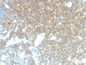 IHC staining of FFPE human lymph node with CD48 antibody (clone CD48/4785). HIER: boil tissue sections in pH 9 10mM Tris with 1mM EDTA for 20 min and allow to cool before testing.