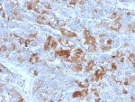 IHC staining of FFPE human adrenal gland with Apolipoprotein J antibody (clone CLU/4731). HIER: boil tissue sections in pH 9 10mM Tris with 1mM EDTA for 20 min and allow to cool before testing.