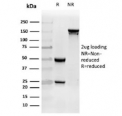 SDS-PAGE analysis of purified, BSA-free Apolipoprotein J antibody (clone CLU/4731) as confirmation of integrity and purity.
