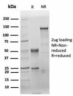 SDS-PAGE analysis of purified, BSA-free recombinant Carcinoembryonic Antigen antibody (clone C66/6470R) as confirmation of integrity and purity.