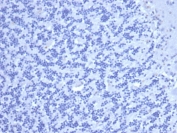 Negative control: IHC staining of FFPE human brain tissue using recombinant Carcinoembryonic Antigen antibody (clone C66/6470R) at 2ug/ml in PBS for 30min RT. HIER: boil tissue sections in pH 9 10mM Tris with 1mM EDTA for 20 min and allow to cool before testing.