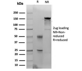 SDS-PAGE analysis of purified, BSA-free CK14 antibody (clone KRT14/4133) as confirmation of integrity and purity.