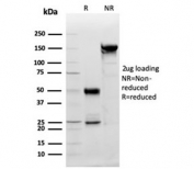 SDS-PAGE analysis of purified, BSA-free PDGF beta antibody (clone PDGFB/3071) as confirmation of integrity and purity.