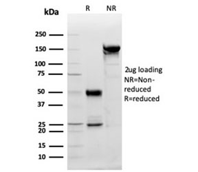 SDS-PAGE analysis of purified, BSA-free PDGF beta antibody (clone PDGFB/3071) as confirmation of integrity and purity.