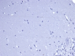 Negative control: IHC staining of FFPE human brain tissue with recombinant CD5 antibody (clone rC5/6462) at 2ug/ml in PBS for 30min RT. HIER: boil tissue sections in pH 9 10mM Tris with 1mM EDTA for 20 min and allow to cool before testing.