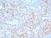 IHC staining of FFPE human tonsil tissue with recombinant CD5 antibody (clone rC5/6462). HIER: boil tissue sections in pH 9 10mM Tris with 1mM EDTA for 20 min and allow to cool before testing.