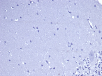 Negative control: IHC staining of FFPE human brain tissue with recombinant CD5 antibody (clone rC5/6462) at 2ug/ml in PBS for 30min RT. HIER: boil tissue sections in pH 9 10mM Tris with 1mM EDTA for 20 min and allow to cool before testing.