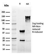 SDS-PAGE analysis of purified, BSA-free recombinant CD5 antibody (clone rC5/6462) as confirmation of integrity and purity.