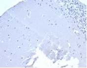 Negative control: IHC staining of FFPE human brain tissue using recombinant CD5 antibody (clone rC5/6429) at 2ug/ml in PBS for 30min RT. HIER: boil tissue sections in pH 9 10mM Tris with 1mM EDTA for 20 min and allow to cool before testing.