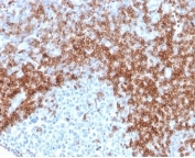 IHC staining of FFPE human tonsil tissue with recombinant CD5 antibody (clone rC5/6429). HIER: boil tissue sections in pH 9 10mM Tris with 1mM EDTA for 20 min and allow to cool before testing.