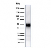 Western blot testing of human Jurkat cell lysate with recombinant CD5 antibody (clone rC5/6429). Observed molecular weight: 55~67 kDa depending on glycosylation level.