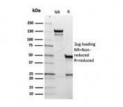 SDS-PAGE analysis of purified, BSA-free recombinant CD5 antibody (clone rC5/6429) as confirmation of integrity and purity.