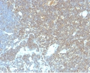 IHC staining of FFPE human lymph node tissue with CD48 antibody (clone CD48/4786). HIER: boil tissue sections in pH 9 10mM Tris with 1mM EDTA for 20 min and allow to cool before testing.