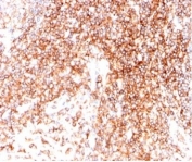 IHC staining of FFPE human tonsil tissue with CD48 antibody (clone CD48/4786). HIER: boil tissue sections in pH 9 10mM Tris with 1mM EDTA for 20 min and allow to cool before testing.