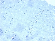 Negative tissue control: IHC analysis of formalin-fixed, paraffin-embedded human brain stained with CTNND1/4501 at 2ug/ml in PBS for 30min RT. HIER: boil tissue sections in pH 9 10mM Tris with 1mM EDTA for 20 min and allow to cool before testing.