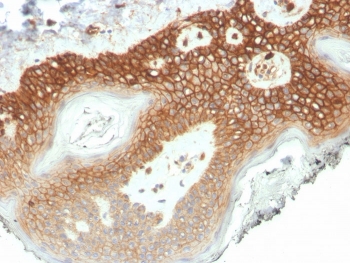 IHC staining of FFPE human colon tissue with Delta 1 Catenin antibody (clone CTNND1/4501) at 2ug/ml in PBS for 30min RT. HIER: boil tissue sections in pH 9 10mM Tris with 1mM EDTA for 20 min and allow to cool before testing.~