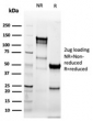 SDS-PAGE analysis of purified, BSA-free recombinant Keratin 8 antibody (clone KRT8/6472R) as confirmation of integrity and purity.