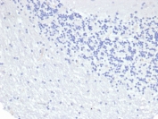 Negative control: IHC staining of FFPE human brain tissue using recombinant Keratin 8 antibody (clone KRT8/6472R) at 2ug/ml in PBS for 30min RT. HIER: boil tissue sections in pH 9 10mM Tris with 1mM EDTA for 20 min and allow to cool before testing.
