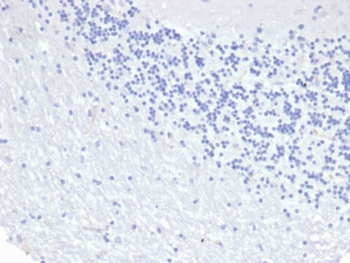 Negative control: IHC staining of FFPE human brain tissue using recombinant Keratin 8 antibody (clone KRT8/6472R) at 2ug/ml in PBS for 30min RT. HIER: boil tissue sections in pH 9 10mM Tris with 1mM EDTA for 20 min and allow to cool before testing.