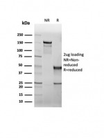 SDS-PAGE analysis of purified, BSA-free recombinant Cystic Fibrosis Transmembrane Regulator antibody (clone rCFTR/6476) as confirmation of integrity and purity.