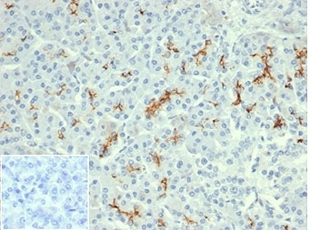 IHC staining of FFPE human pancreatic tissue with recombinant Cystic Fibrosis Transmembrane Regulator antibody (clone rCFTR/6476). Negative control inset: PBS used instead of primary antibody to control for secondary Ab binding. HIER: boil tissue sections in pH 9 10mM Tris with 1mM EDTA for 20 min and allow