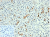IHC staining of FFPE human pancreatic tissue with recombinant Cystic Fibrosis Transmembrane Regulator antibody (clone rCFTR/6476). Negative control inset: PBS used instead of primary antibody to control for secondary Ab binding. HIER: boil tissue sections in pH 9 10mM Tris with 1mM EDTA for 20 min and allow to cool before testing.