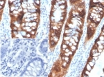 IHC staining of FFPE human colon tissue with PDGFB antibody (clone PDGFB/3072). Negative control inset: PBS instead of primary antibody to control for secondary binding. HIER: boil tissue sections in pH 9 10mM Tris with 1mM EDTA for 20 min and allow to cool before testing.