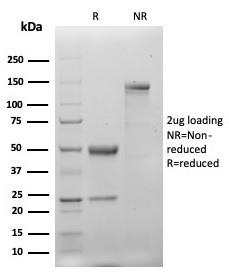 SDS-PAGE analysis of purified, BSA-free recombinant Keratin 20 antibody (clone KRT20/4879R) as confirmation of integrity and purity.