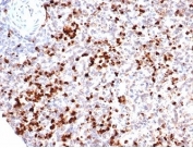 IHC staining of FFPE human spleen tissue with recombinant MPO antibody (clone rMPO/6904). HIER: boil tissue sections in pH 9 10mM Tris with 1mM EDTA for 20 min and allow to cool before testing.