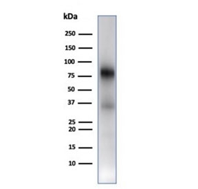 Western blot testing of human spleen tissue lysate using recombinant MPO antibody (clone rMPO/6904). Expected molecular weight: 75-90 kDa (pro form).