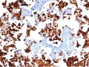 IHC staining of FFPE human bone marrow with recombinant MPO antibody (clone rMPO/6904). HIER: boil tissue sections in pH 9 10mM Tris with 1mM EDTA for 20 min and allow to cool before testing.