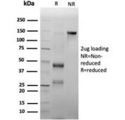SDS-PAGE analysis of purified, BSA-free MPO antibody (clone rMPO/6904) as confirmation of integrity and purity.