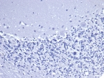 Negative control: IHC staining of FFPE human brain tissue with recombinant CD5 antibody (clone C5/6463R) at 2ug/ml in PBS for 30min RT. HIER: boil tissue sections in pH 9 10mM Tris with 1mM EDTA for 20 min and allow to cool before testing.