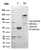 SDS-PAGE analysis of purified, BSA-free recombinant CD5 antibody (clone C5/6463R) as confirmation of integrity and purity.