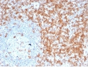 IHC staining of FFPE human tonsil tissue with recombinant CD5 antibody (clone C5/6463R). HIER: boil tissue sections in pH 9 10mM Tris with 1mM EDTA for 20 min and allow to cool before testing.