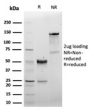 SDS-PAGE analysis of purified, BSA-free recombinant CD5 antibody (clone C5/6463R) as confirmation of integrity and purity.