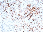 IHC staining of FFPE human spleen tissue with MPO antibody (clone MPO/7116). Negative control inset: PBS instead of primary antibody to control for secondary binding. HIER: boil tissue sections in pH 9 10mM Tris with 1mM EDTA for 20 min and allow to cool before testing.