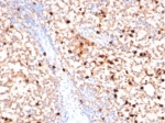 IHC staining of FFPE human bone marrow with MPO antibody (clone MPO/7116). HIER: boil tissue sections in pH 9 10mM Tris with 1mM EDTA for 20 min and allow to cool before testing.