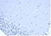 Negative control: IHC staining of FFPE human brain tissue using recombinant CD5 antibody (clone C5/6438R) at 2ug/ml in PBS for 30min RT. HIER: boil tissue sections in pH 9 10mM Tris with 1mM EDTA for 20 min and allow to cool before testing.