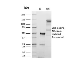 SDS-PAGE analysis of purified, BSA-free recombinant CD5 antibody (clone C5/6438R) as confirmation of integrity and purity.