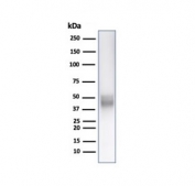 Western blot testing of human Jurkat cell lysate with CD5 antibody. Observed molecular weight: 55~67 kDa depending on glycosylation level.