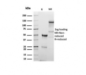 SDS-PAGE analysis of purified, BSA-free recombinant CD5 antibody (clone C5/6438R) as confirmation of integrity and purity.