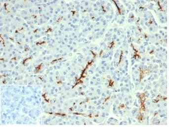 IHC staining of FFPE human pancreatic tissue with recombinant CFTR antibody (clone CFTR/6477R). Negative control inset: PBS used instead of primary antibody to control for secondary Ab binding. HIER: boil tissue sections in pH 9 10mM Tris with 1mM EDTA for 20 min and allow to cool before testing.~