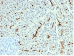 IHC staining of FFPE human pancreatic tissue with recombinant CFTR antibody (clone CFTR/6477R). Negative control inset: PBS used instead of primary antibody to control for secondary Ab binding. HIER: boil tissue sections in pH 9 10mM Tris with 1mM EDTA for 20 min and allow to cool before testing.